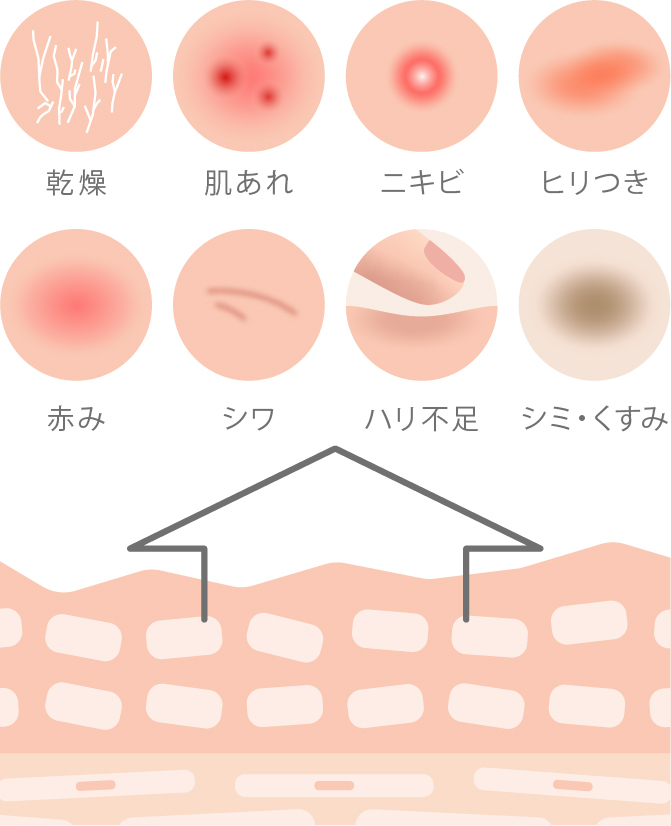 角層バリアの乱れ