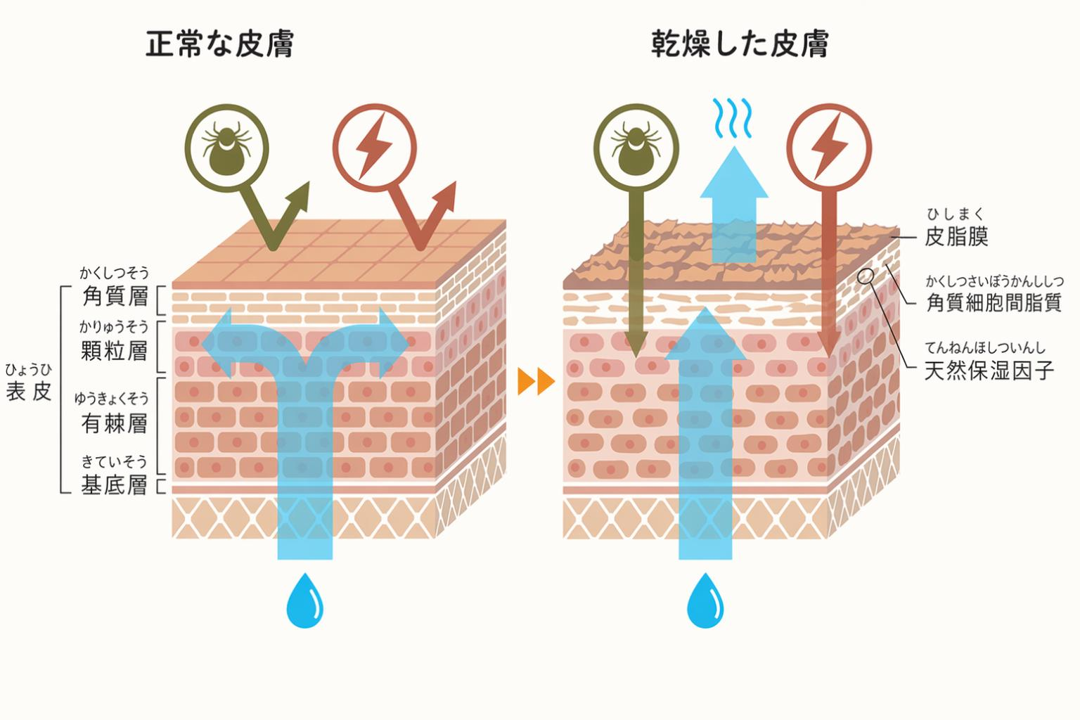 小児の皮膚:正常な皮膚と乾燥した皮膚のイメージ図